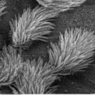 Bronchiolar epithelium (I)