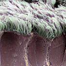 Bronchiolar epithelium (II)