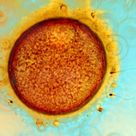 Egg and sperms (I)