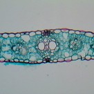Cross section of a leaf (III)