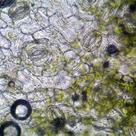 Stomata (II)