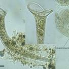 <i>Stentor roeseli</i>