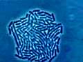 Bacterian growth